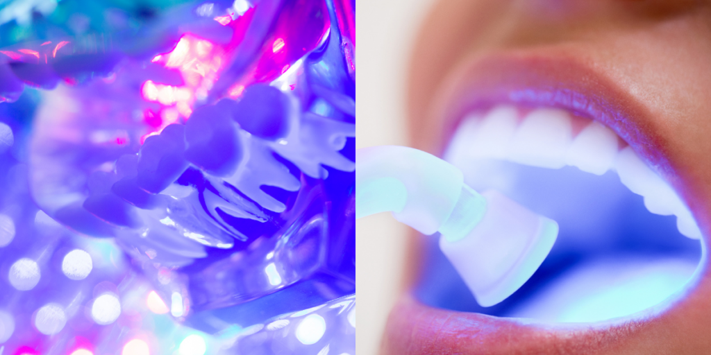 63304 Dentist performing a fluorescent oral cancer screening using specialized light technology to detect early signs of oral abnormalities.