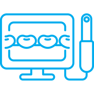 Intraoral cameras used by a Lake St. Louis dentist for detailed and accurate dental diagnostics and treatment planning.