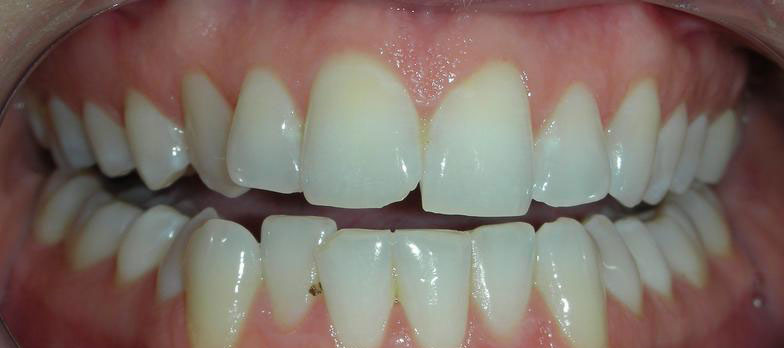 Before